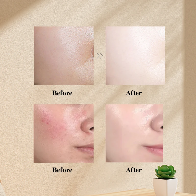 Wholesale Korean Grape Hyaluronic Acid Powder Facial Moisturizing Jelly Mask