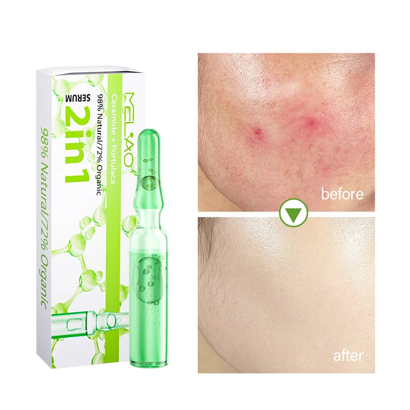 OEM Private Label Organic Vegan moisturizing acne pore improvement anti wrinkle aging acne whitening Ampoule serum of Purslane