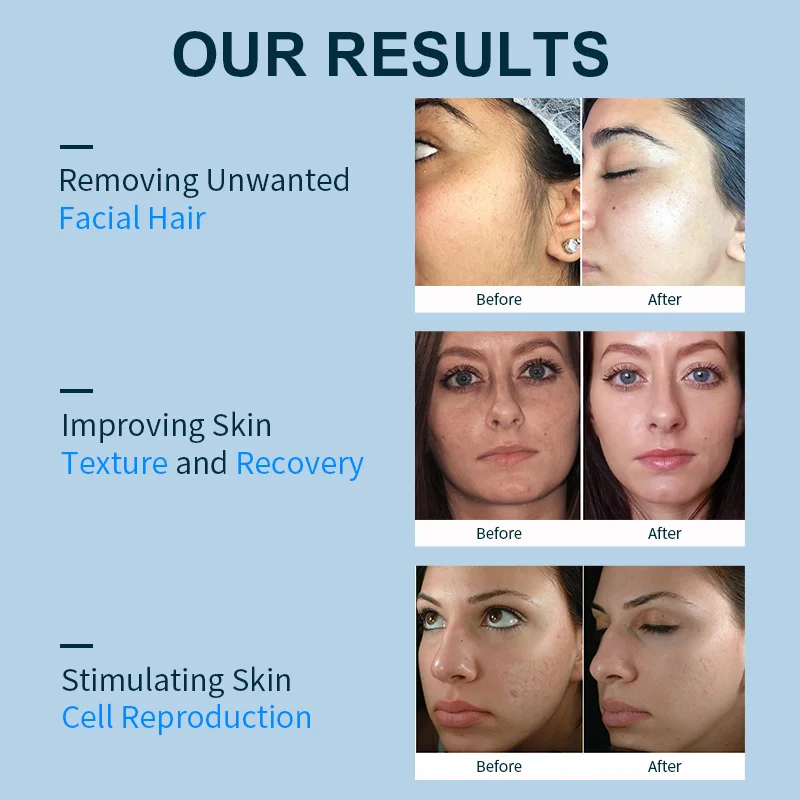 Wireless Charging dermaplaning and hair remover tool dermaplane skincare