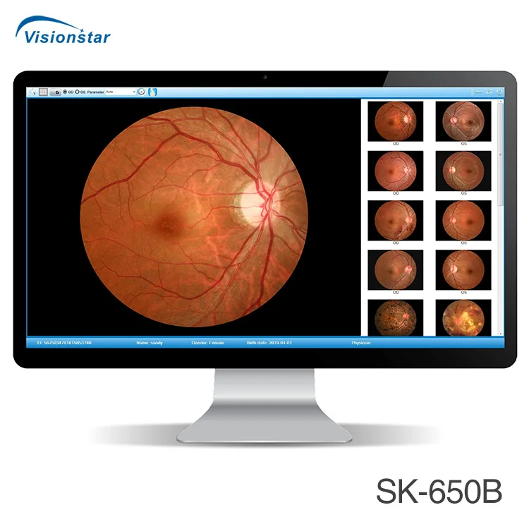 Popular Model SK-650B Non-mydriatic Fundus Camera