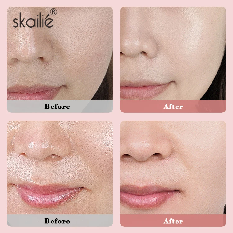 Custom Organic Skin Care Facial Deep Cleansing Nourishing Brighten Kaolin Rose Pink Clay Mask