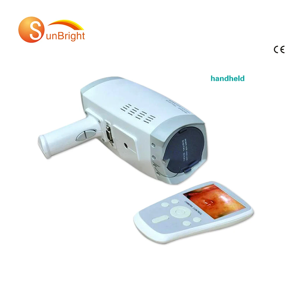 SUN-200Y clear images Colposcope handheld small famous brand camera medical gynecology