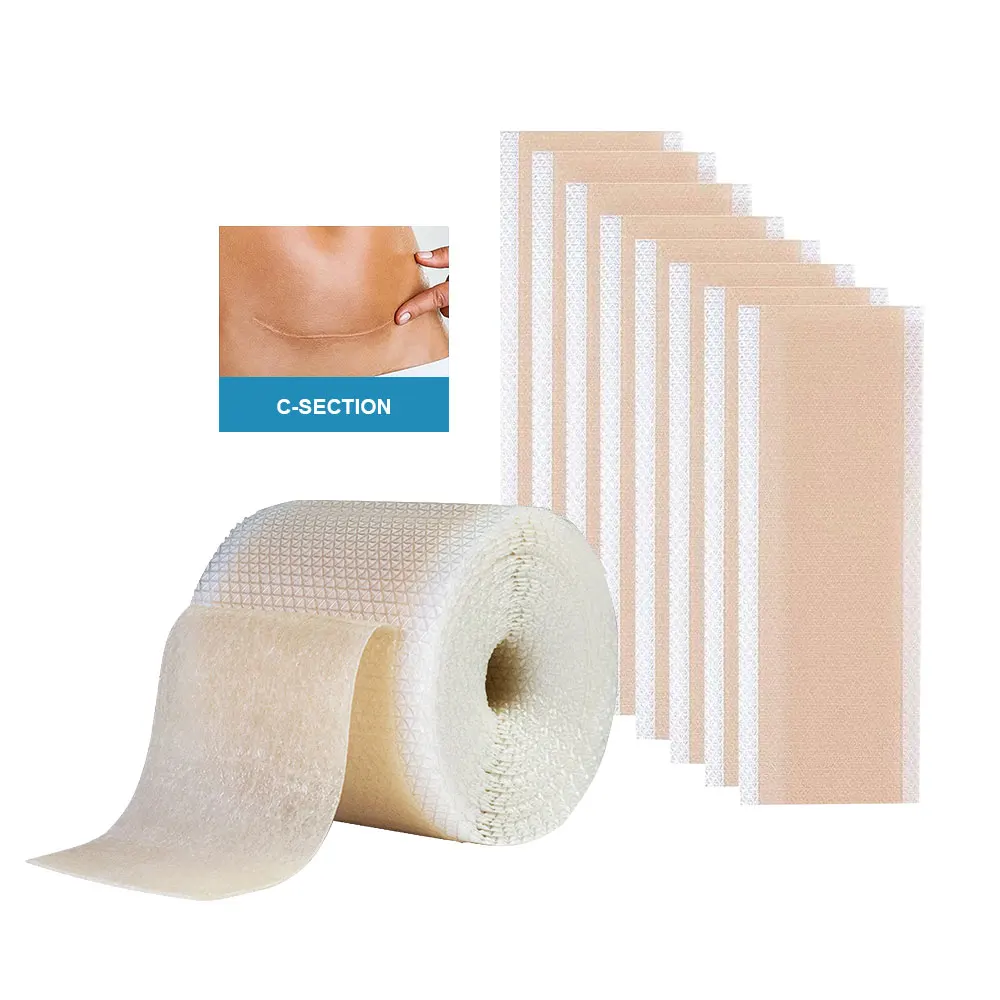 Hot Sales Skin Care Acne Scar Treatment Medical Silicone Scar Romover Sheet