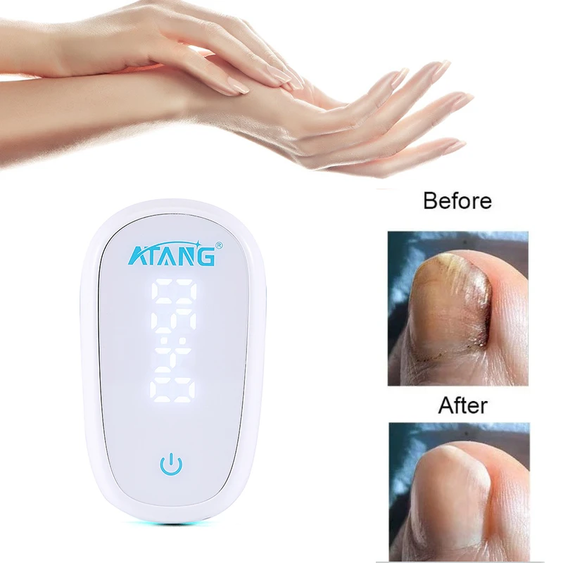 ATANG Onychomycosis fungus nail toenail fungus Nail Fungus Treatment laser