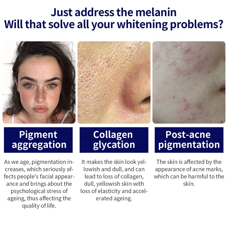 Wholesale 30ml Organic Face Skin Care Corrector Serum Clearly Corrective Dark Spot Solution