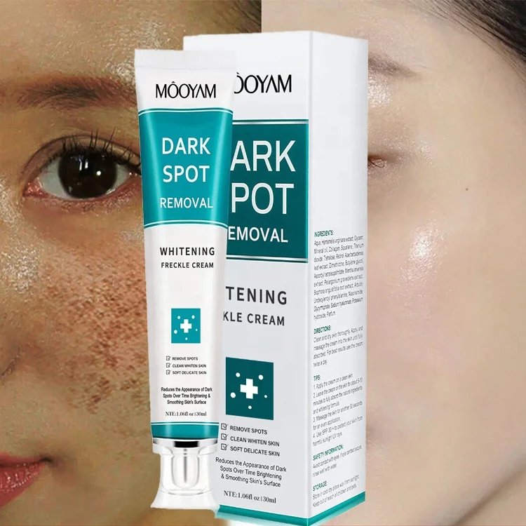 Customized Original Strong Anti Freckle Whitening Cream Powerful Removing Age Dark Spots Pigmentation Whitening Cream