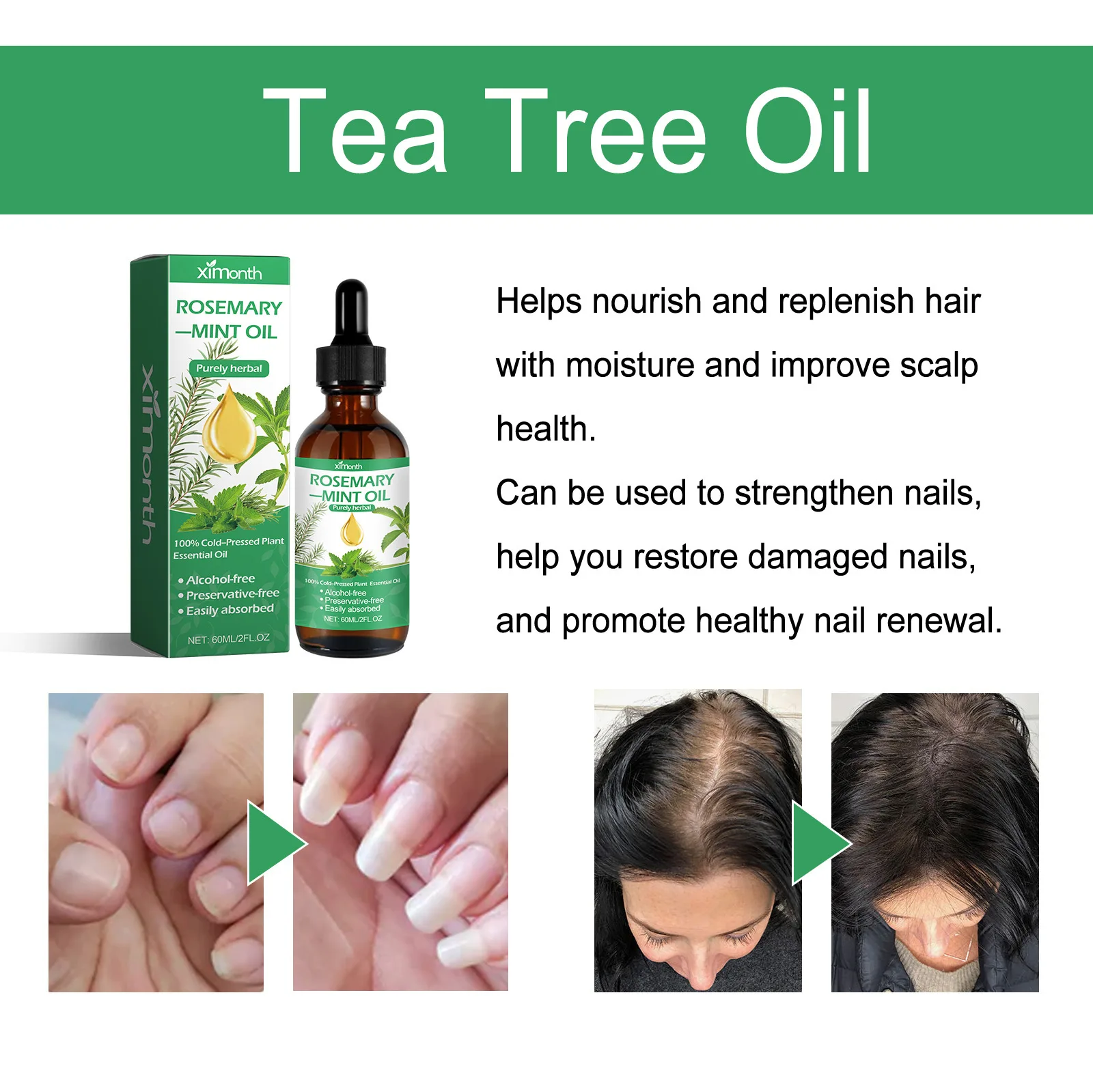 Ximonth rosemary mint dense hair lotion human dense solid hair hand and foot nail care essence