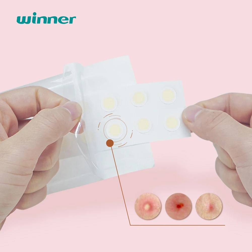 advanced hydrocolloid dressing manufacturer organic acne healing pimple cover patch