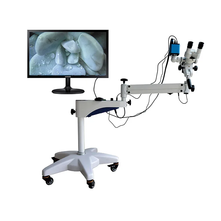 Colposcope High Resolution Colposcope Video Camera Optical Lens Binocular Vision