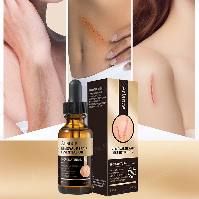 ODM OEM custom supplier Essential Oil Stretch Mark Body Pregnancy Scars Remove Essential Oil