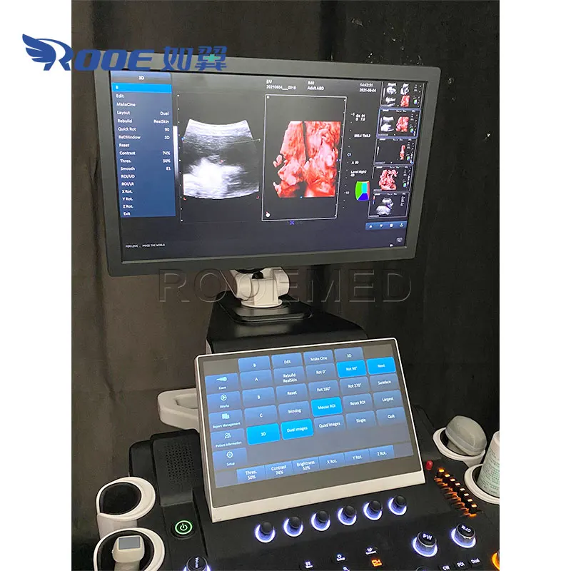 USC80 Профессиональный гинекологический допплеровский ультразвуковой аппарат 4D RealSkin 5D с тележкой