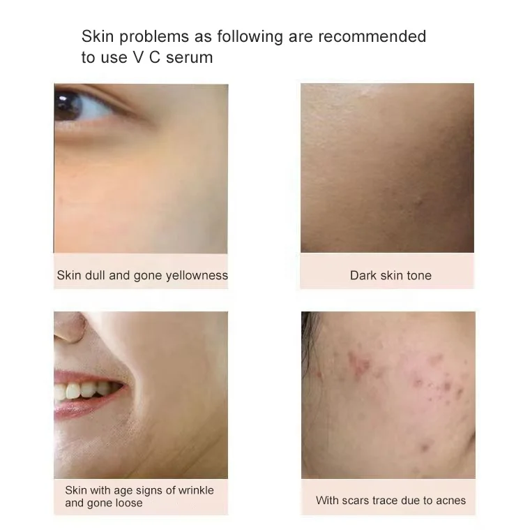 Cosmetics factory OEM freckle fading reduce wrinkle aging whitening vitamin c serum with 15% L- ASCORBIC ACID