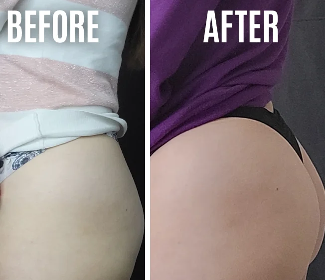 OEM ODM Natural Formula Bigger Buttock Enlargement Massage Hip Up Lift Firming Butt Enhancement Cream