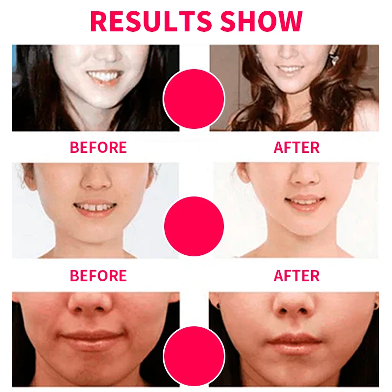 Double V Slimming Face Make Chin Firm Shape Line Lifting Lift Shaped Strap Shapeface Reducer Mask Slim Band Patch