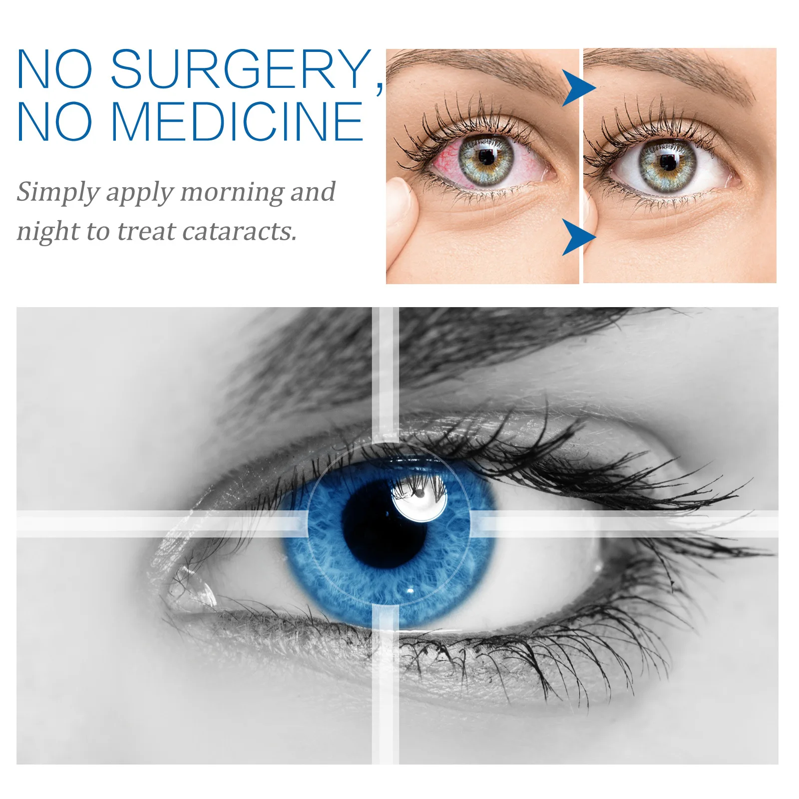 South Moon Custom Logo Cataract Glaucoma Dry Eye Treatment Cold Compress Gel