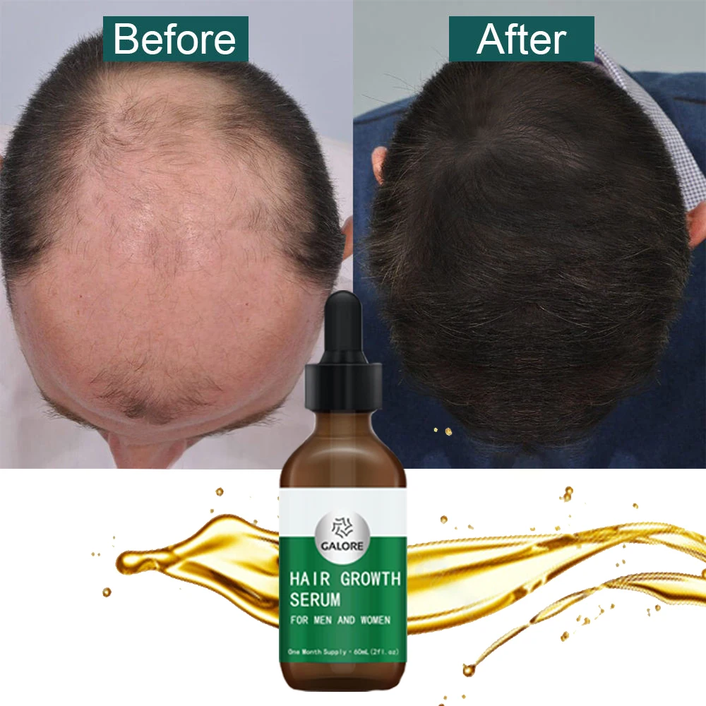 100% Natural   Hair Growth Serum Private Label mix herbs  Oil for Men and Women