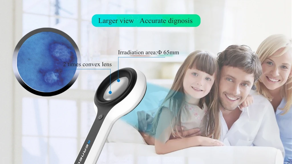 KN- 9000C 2020 new Medical woods lamp for dermatoscope skin analyzer Medical Woods Lamp for skin disease tester