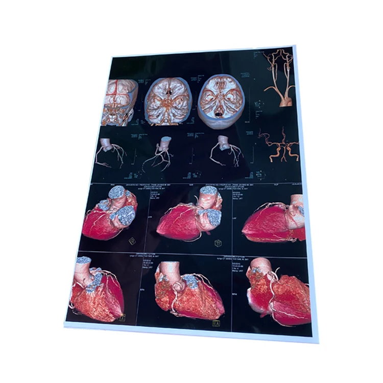 A4 White Ultrasound Inkjet Printable Dicom Medical Film