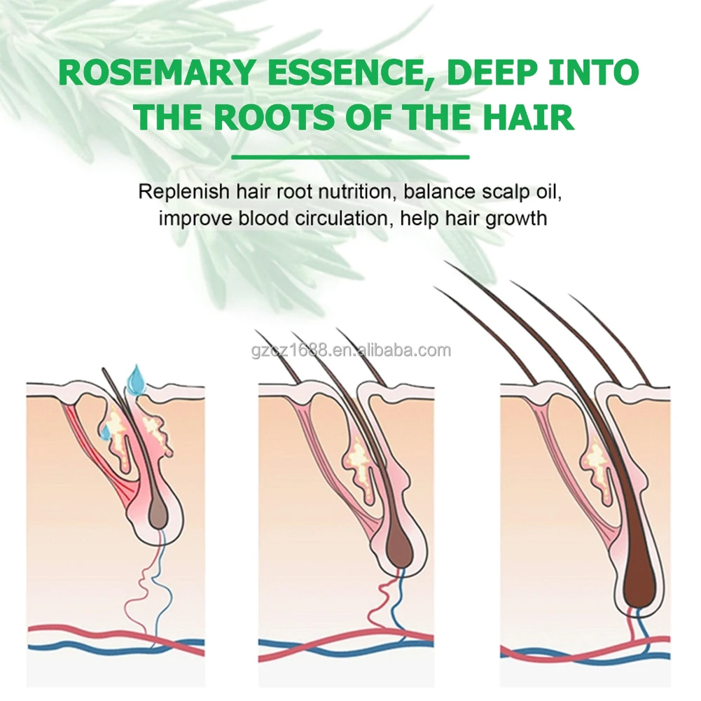 New Arrival Best Hair Care Product Anti Loss Regrowth Scalp Treatment Castor Oil Hair Growth Oil Serum for Black Hair