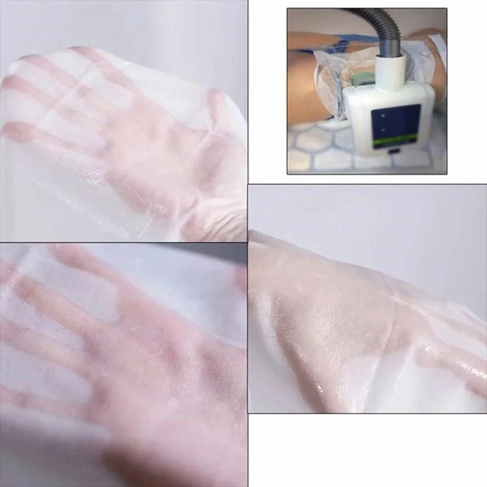 Iii Freezefat Anti Freezing Membrane Etg For Cryolipolyse Slimming Machine Membrane