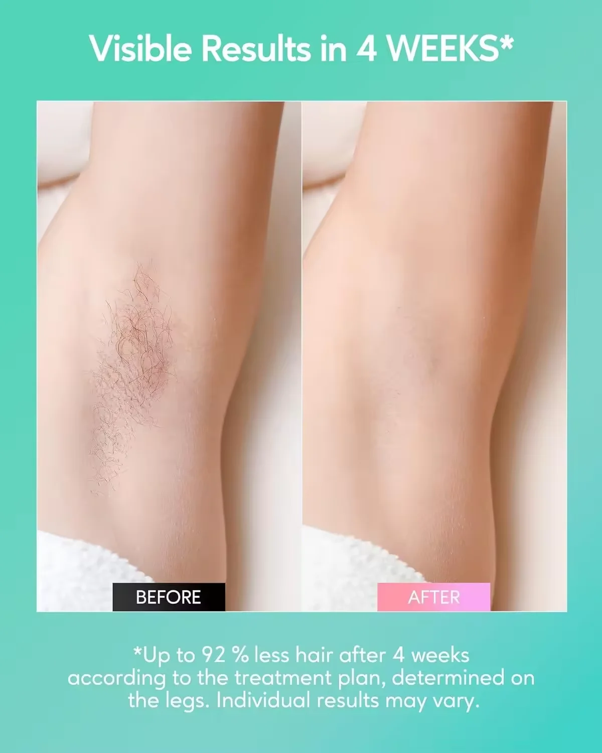 China Wholesale Effective Ipl Hair Removal Device Hair-Free Smooth Skin for Women and Me