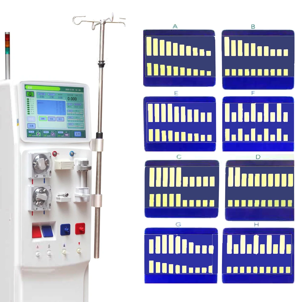 MY-O018 Hot sale hemodialysis machine for hospital blood dialysis machine dialysis machine kidney hemodialysis