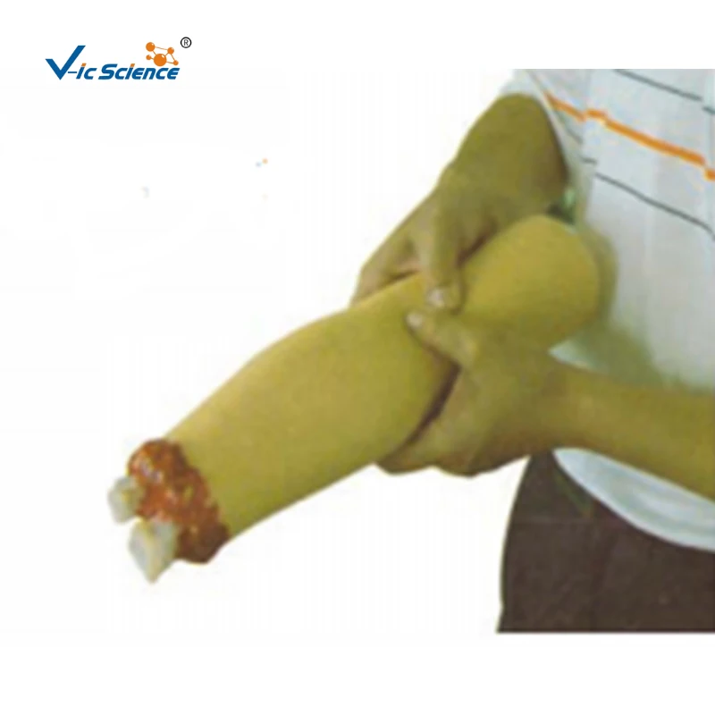 Hemostasis model of severed limb after upper limb trauma medical skills training model medical simulators for training