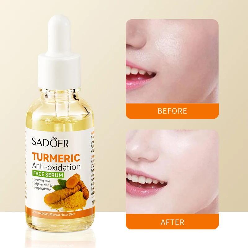 OEM SADOER Private Label Ginger Turmeric Whitening Skin Care Serum Facial Antioxidant Nourishing Moisturizing Repair Face Serum