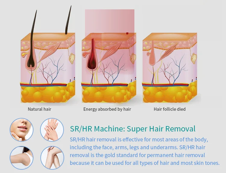 Huamei opt ipl hair removal professional machine dark spots removal e-light ipl skin rejuvenation machine