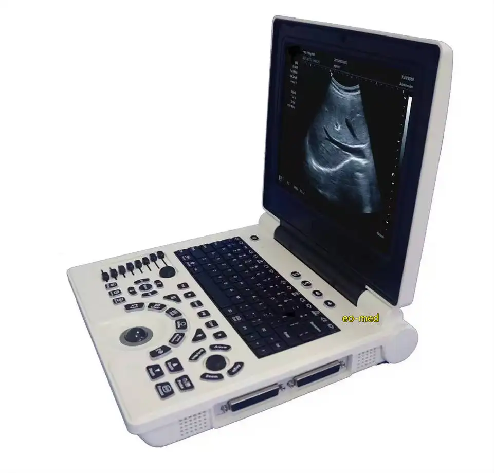 Medical Supplies High Quality Fully Digital Portable Ultrasound Scanner Ultrasound Scanning Machine BW20