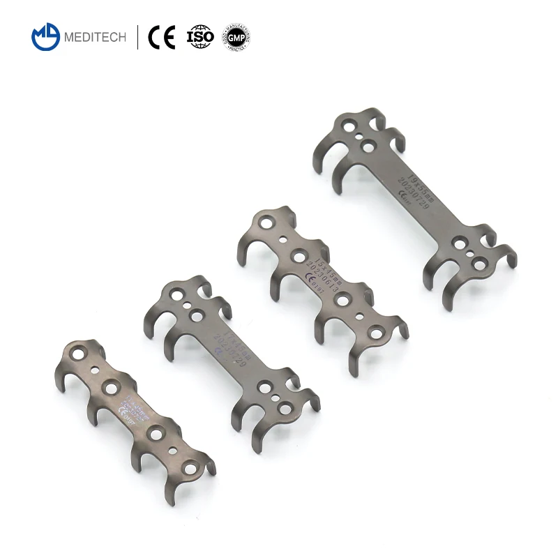 Orthopedic Titanium Patented Rib Bone Plate Ortho Implants For Rib Bone Fracture