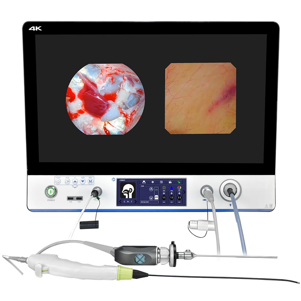 Portable medical UHD endoscope system, check all-in-one otolaryngology endoscopic surgery with a 24-inch monitor