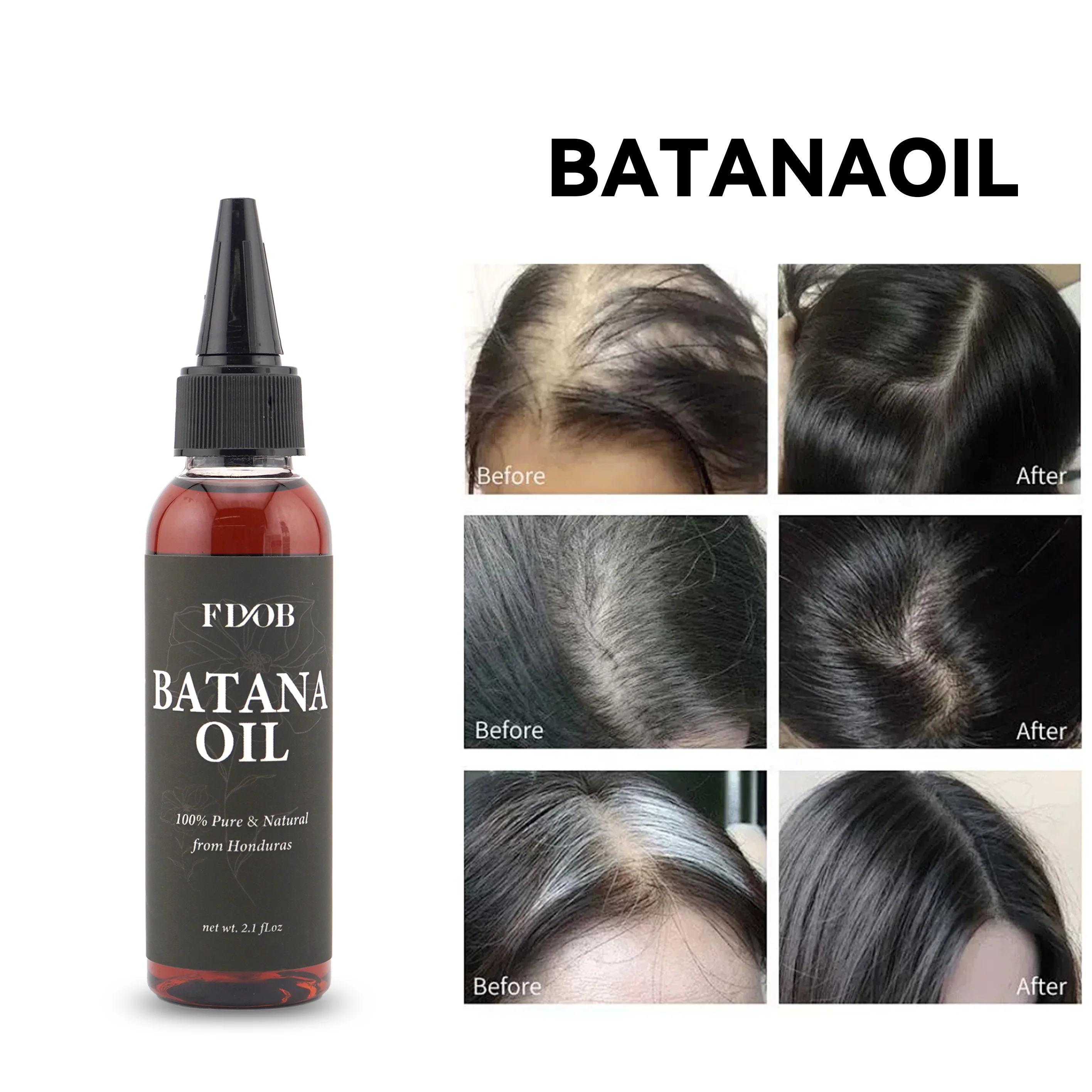 Best Seller Hair Growth Promotes Hair Wellness for Men  Women Enhances Hair and Skin Radiance 60ml Batana Oil