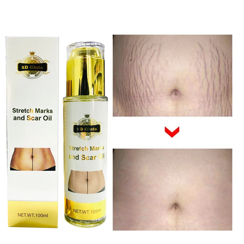 5D Gluta Stretch Mark Cream Organic Natural Skin Firming Removes Scar Postpartum Repair Scar Stretch Marks Removal Oil