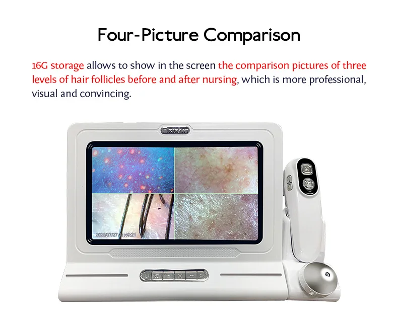 hot professional hair analysis machine for beauty salon intelligent home use hair analyzer machine