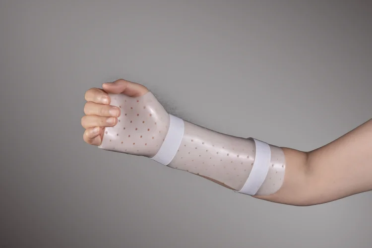 Perforated Thermoplastic Orthopedic Splint for Orthopedic Physiotherapy Hand Wrist Immobilization Bandage Fixation