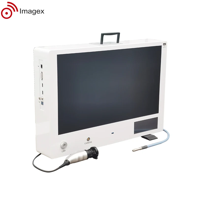 Affordable Compact Endoscope Camera System with Image Recording and Adjustable Monitor