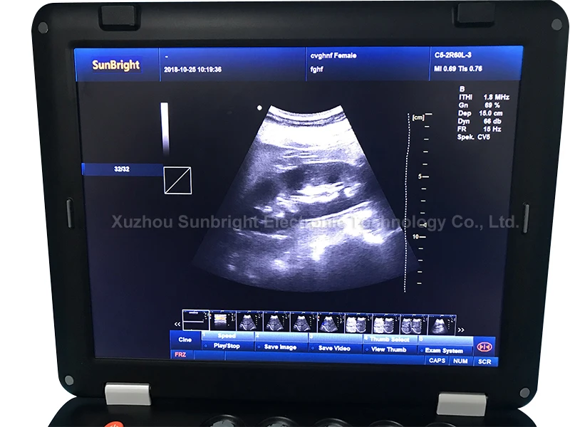 CE 4D one stop whole body diagnosis best image quality color Doppler ultrasound PW CW ultrasound baby