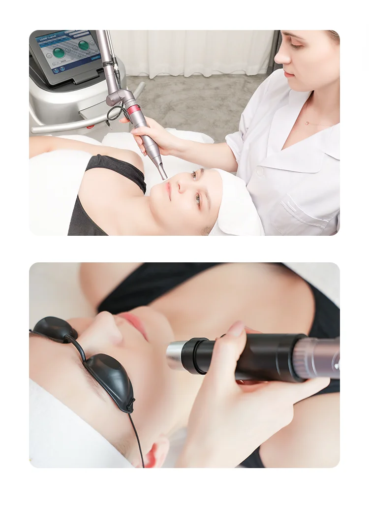 qswitch picocare lutron q switched nd yag picolaser picosecond pico laser spectra tattoo removal tattoos tattoo remove machine