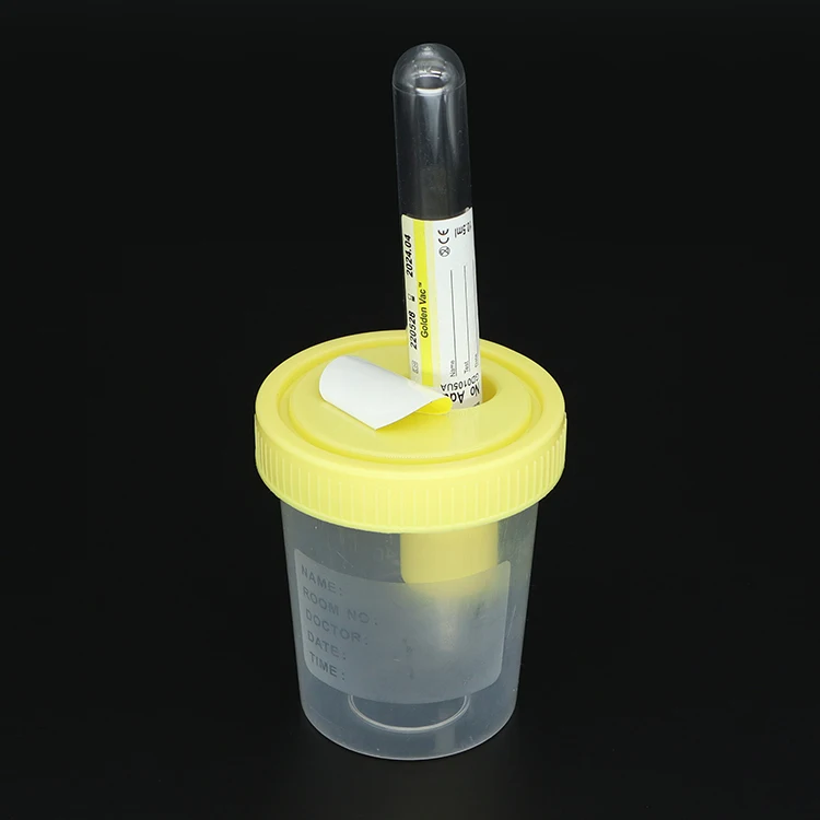 EO sterile yellow cap vacuum urine container 120 ml with 5ml urine tube