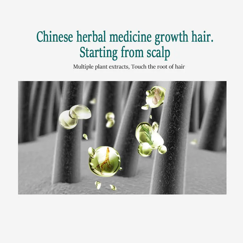 Private Label Herbal Painless Hair Care Serum Anti Hair Loss Treatment Fast Growing Germinal Hair Serum