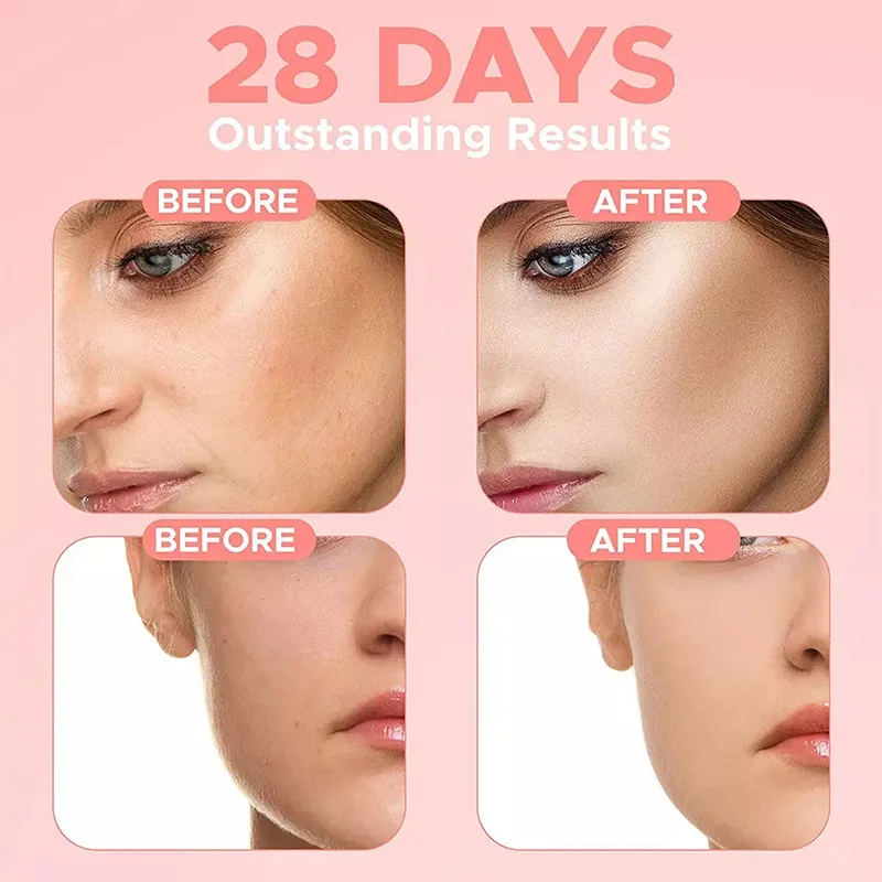 korean 4 in 1 30% vitamin C 5% Niacinamide skin care anti wrinkles hydrating moisturizing whitening facial serum face serum 30ml