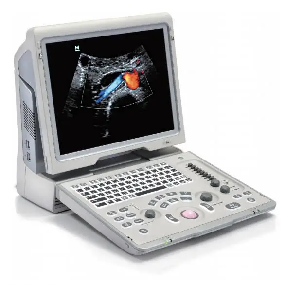 hot sale Mindray Z6 Portable color doppler ultrasound machine price CW Function, cheapest portable ultrasound therapy machine