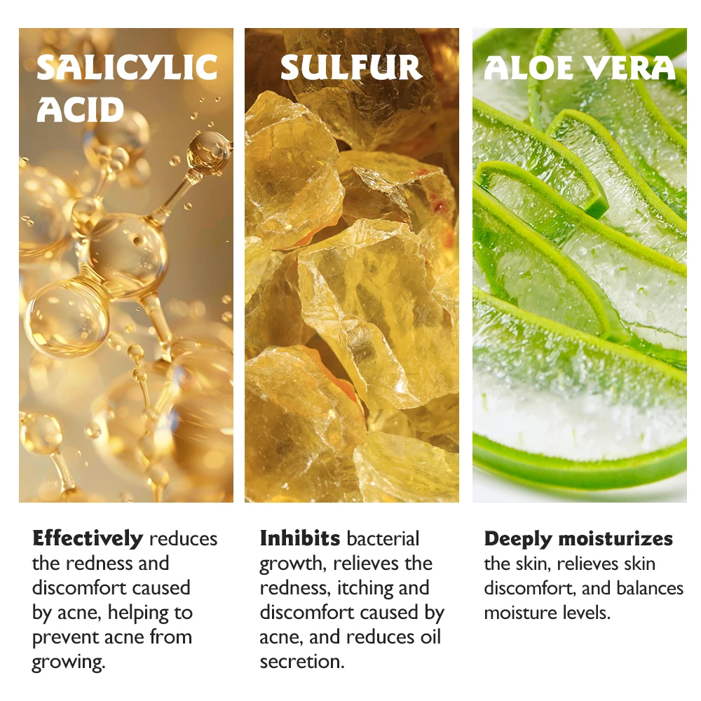 Refreshing Gel Body Wash Salicylic Acid Sulfur Infused Anti-Acne Anti-Mite Skin Care Adults Herbal Formula Liquid SKINEVER