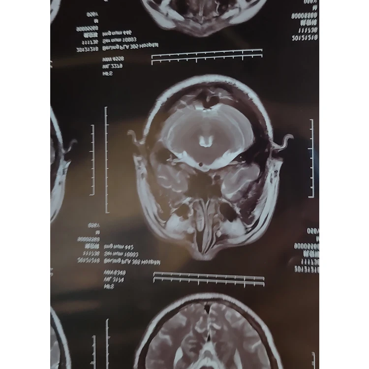 
medical dry imaging film DI-HT 