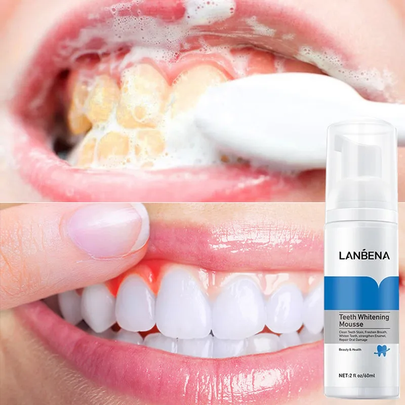 Lanbena Teeth Whitening Mousse Tooth Whitening Cleaning White Teeth Oral Hygiene Toothpaste Bleaching Remove Stains Dental Tool
