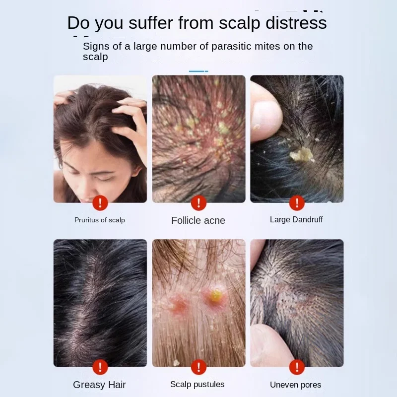 Thai Factory Direct Reclining Buddha Hair Follicle Yan Cream Keratin Anti-Itch Scalp Care Back Pores Chinese Plaster Clearing