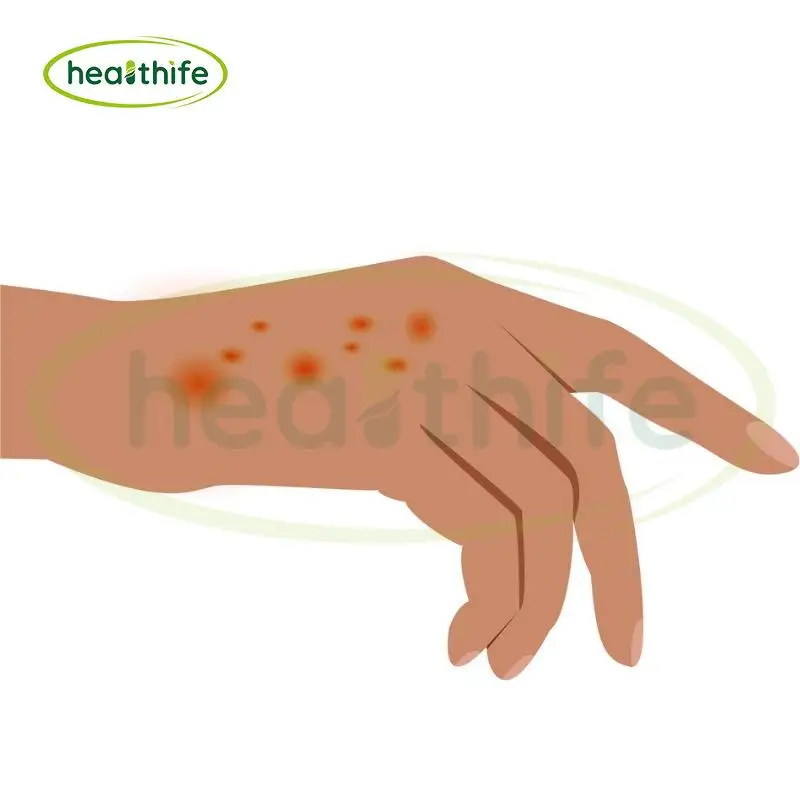 Healthife Vitamin B2 98% Riboflavin 5 Sodium Phosphate