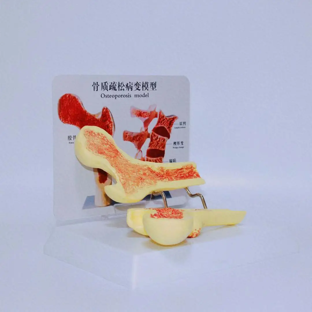 2021 new listing made of durable materials dedicated to teaching osteoporosis skeleton model