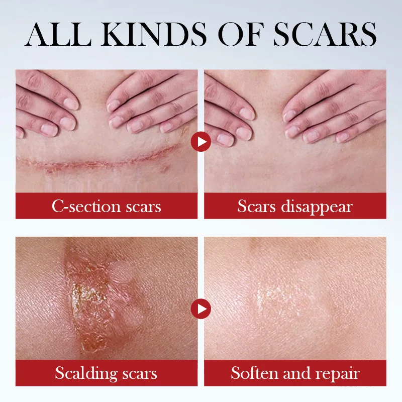 OEM SADOER FAYANKOU Skin Care Serum Ceramide Soothing Scar Repair Serum Private Label Facial Serum